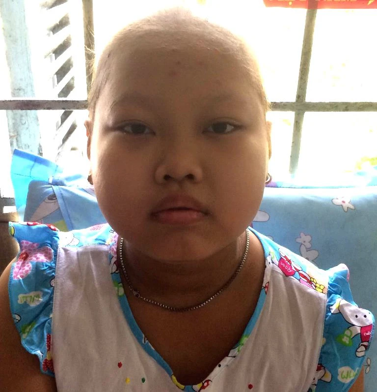 Giúp cháu Thùy trị bệnh ung thư máu